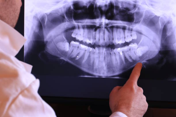 Best Emergency Dental Services for Seniors in East Bakersfield, CA